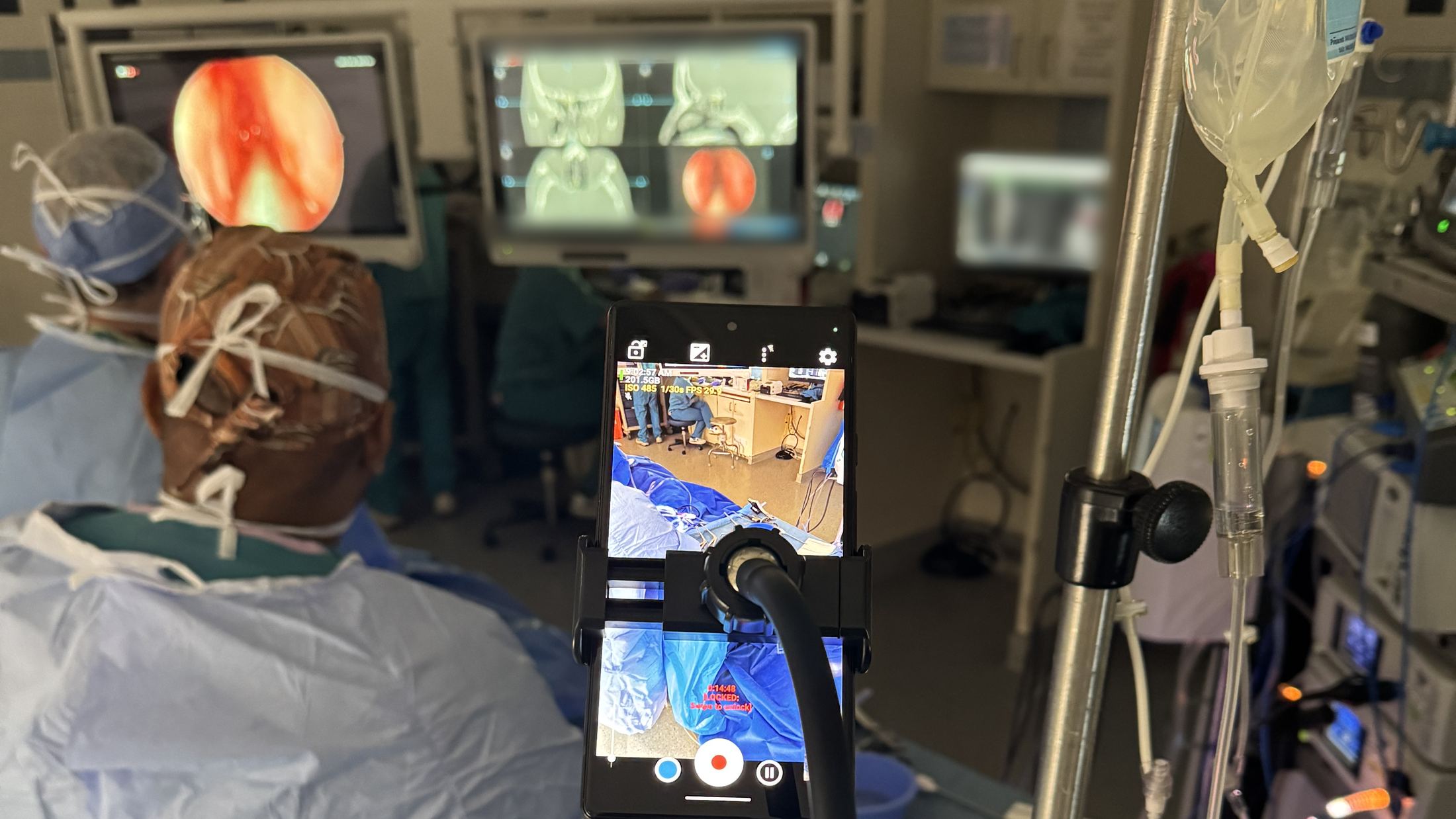 A camera rig recording a live surgical case for AI analysis, with the surgical team and navigation screens behind it