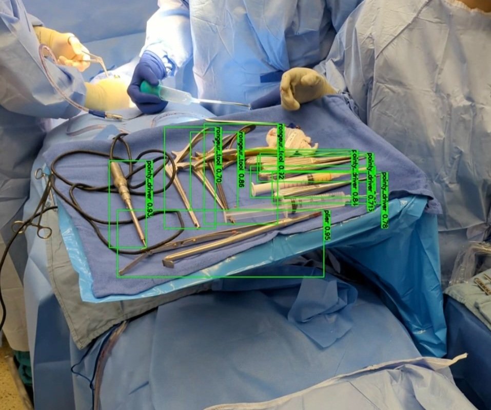 Surgical procedure with AI overlay